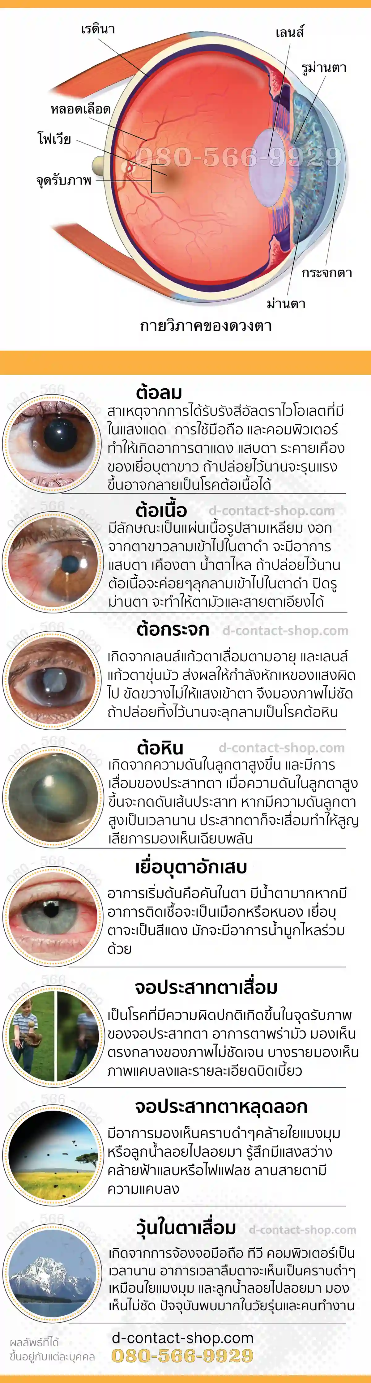 ปัญหาสุขภาพสายตา